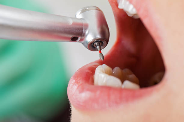 Best Mobile Emergency Dentist in Marion, IA